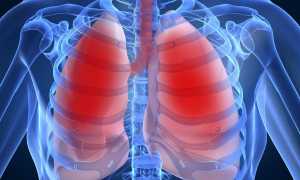 Причины и эффективное лечение при кашле с кровянистой мокротой